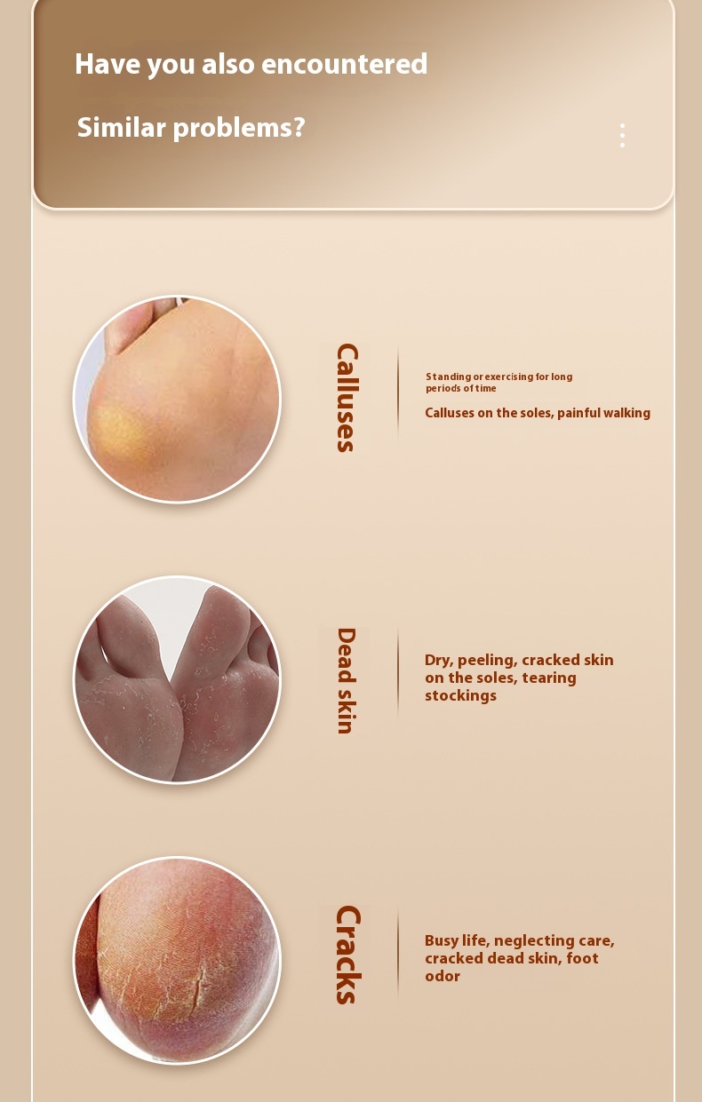 Electric Foot Grinder Household Automatic Foot Grinding For Removing Dead Skin And Calluses A For Beautiful Feet And Foot Care - Image 2